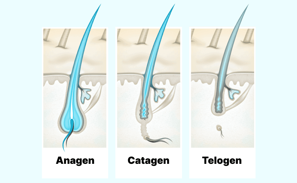 Wissenschaftliche Illustration des Haarzyklus (Anagen, Katagen, Telogen) und dessen Störung bei Telogenem Effluvium.